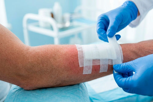 Какая мазь лучше помогает от гнойных ран?